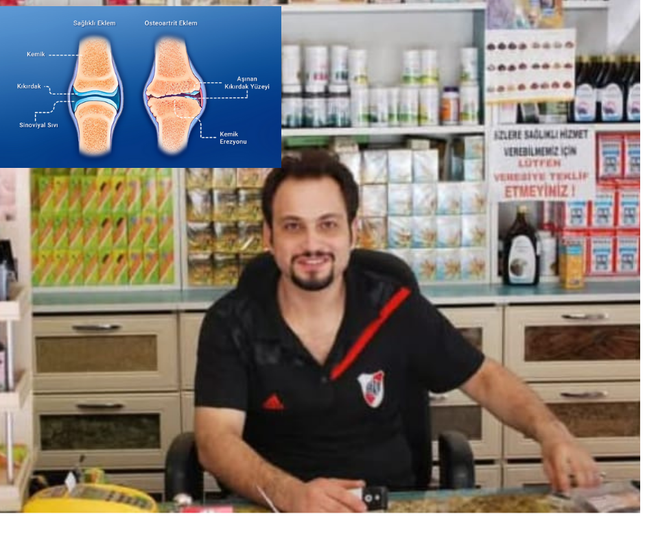 Çağın hastalığı Eklem dejenarasyonu Çağın hastalığı Eklem dejenarasyonu